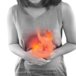 Acidity / Acid Reflux : How to Manage And Avoid