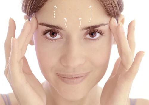 Brow lift