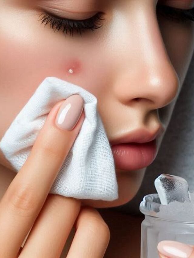 Natural Ways to Clear Acne Fast