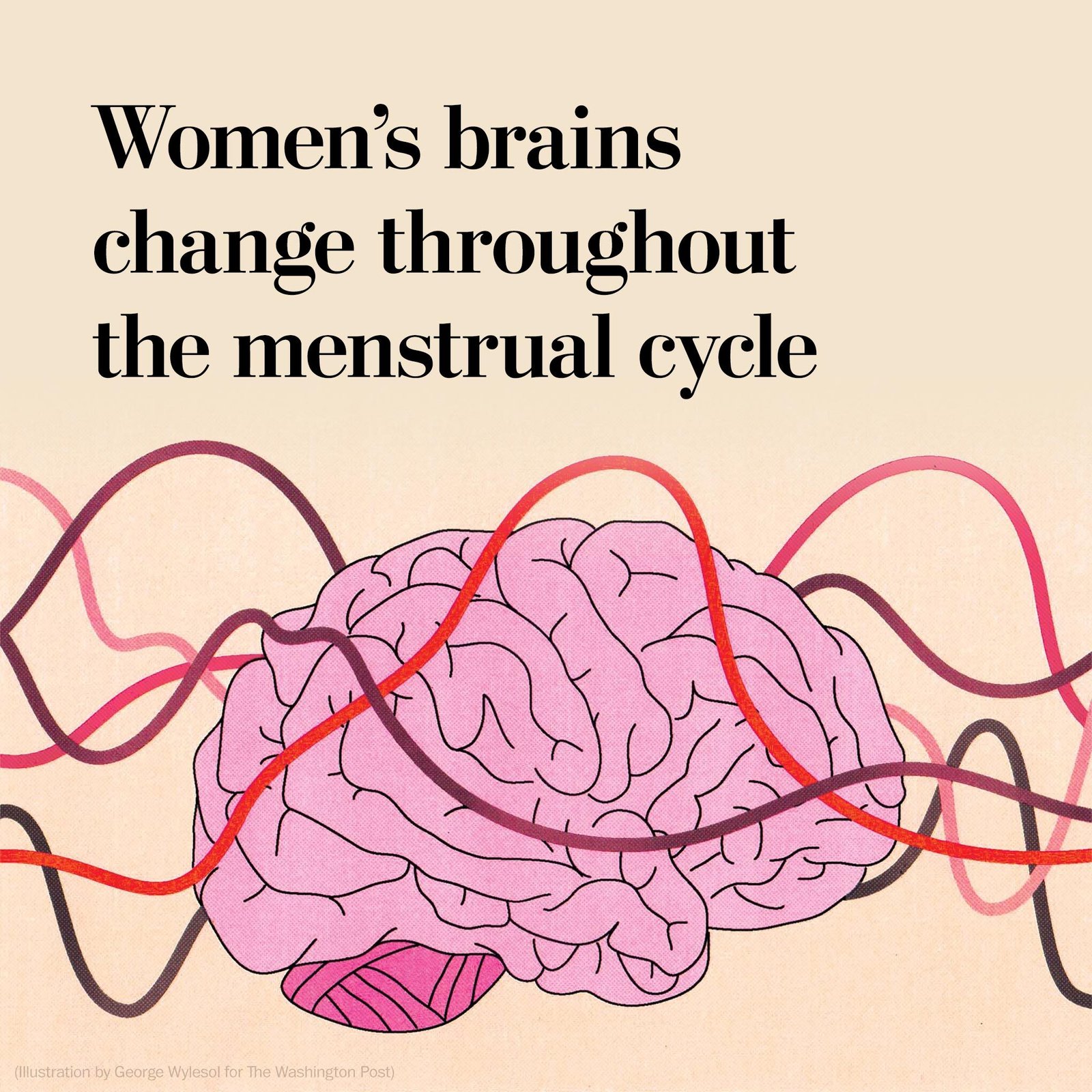Altered Pain Perception