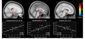 Brain Structural Changes During Menstruation